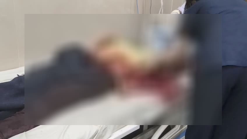 Bilaspur attack news : तीन सगी बहनों पर धारदार हथियार से जानलेवा हमला, किराए के मकान में रहती थी तीनों,