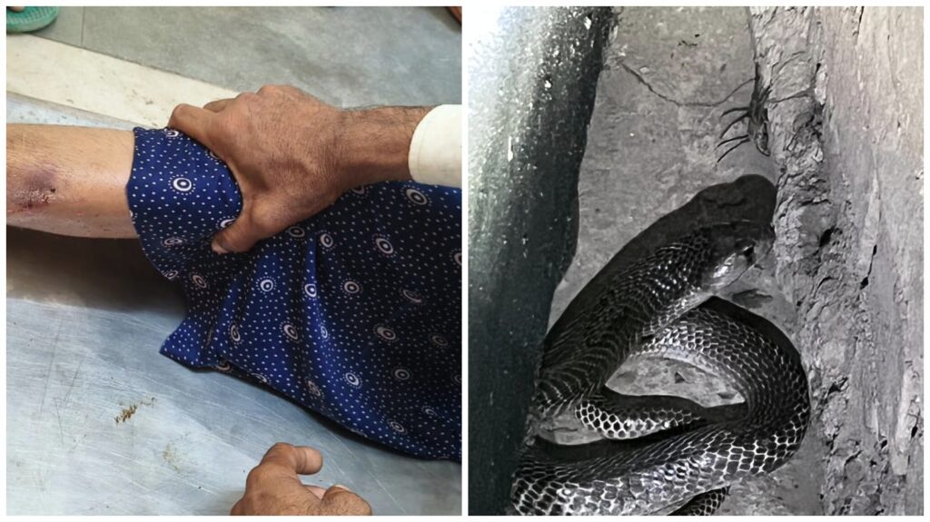 Snake Attack : सांप ने मासूम बच्ची को डसा 