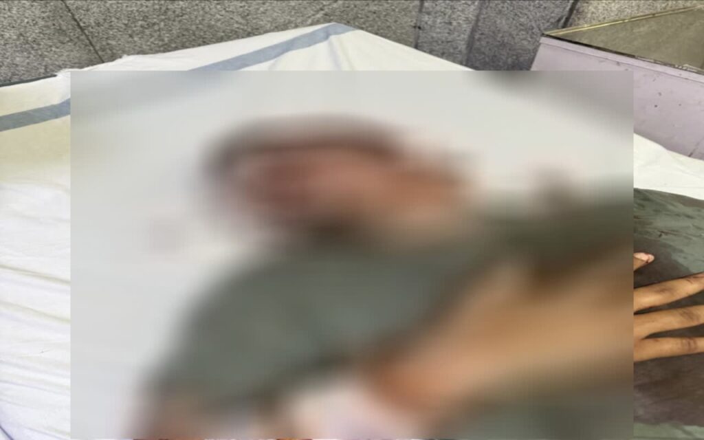 Knife attack in jail : सेंट्रल जेल में गैंगवार: तांत्रिक का करीबी और कांग्रेस नेता चाकूबाजी में घायल, 